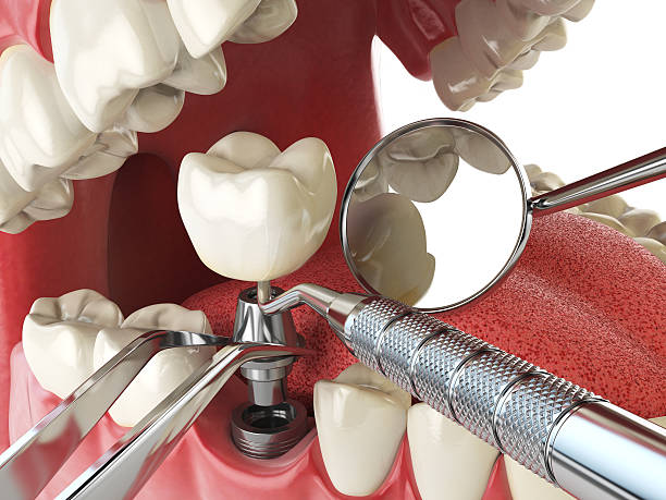 Best Emergency Care for Gum Disease in Coldwater, MI