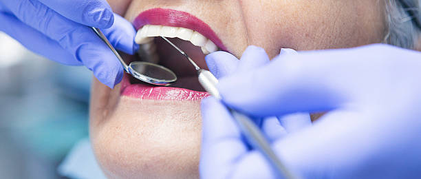 Best Lost Filling or Crown Replacement in Coldwater, MI